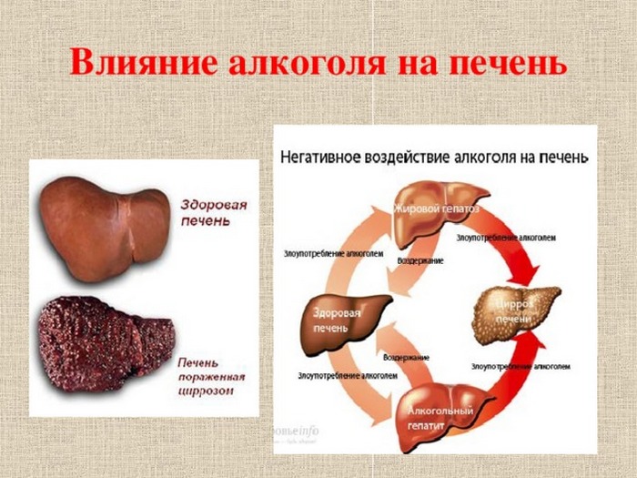 Как в домашних условиях заставить бросить пить Как в домашних условиях заставить бросить пить