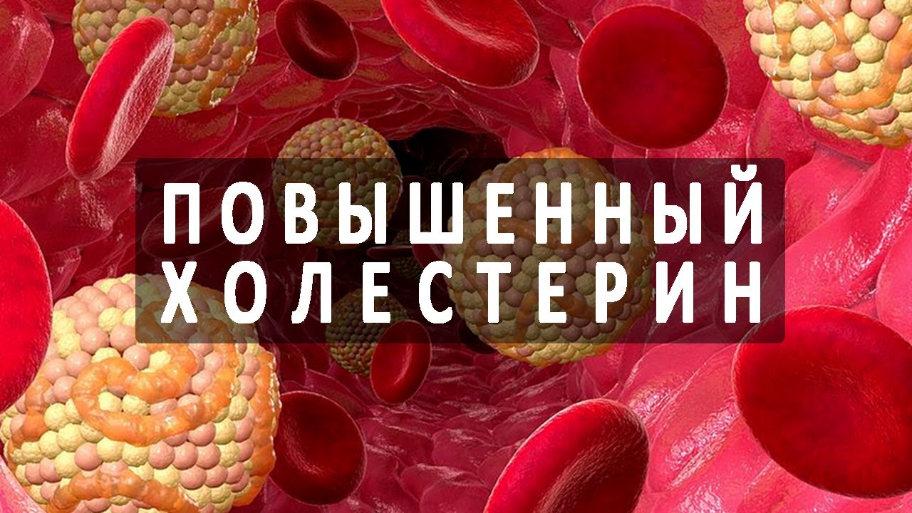С чем связано повышенный холестерин С чем связано повышенный холестерин