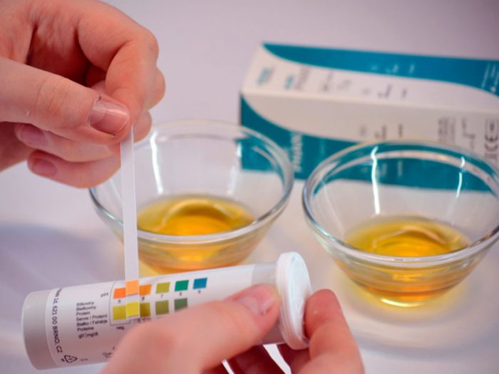 тест полоски для определения алкоголя в моче