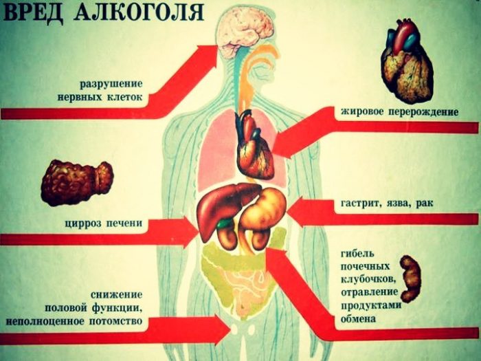 Последствия употребления алкоголя картинки